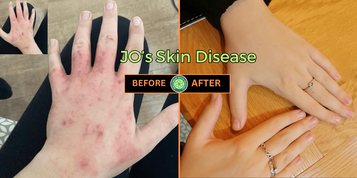 before and afrter (14)